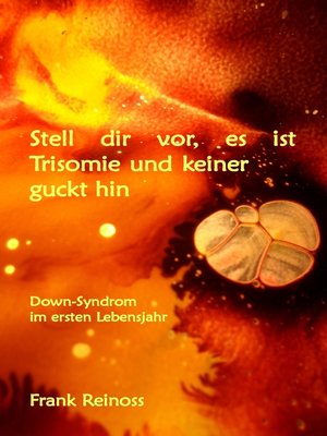 cover image of Stell dir vor es ist Trisomie und keiner guckt hin